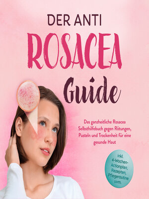 cover image of Der Anti Rosacea Guide